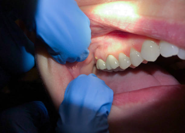 Best Emergency Dental Care for Trauma or Injury in Linwood, PA